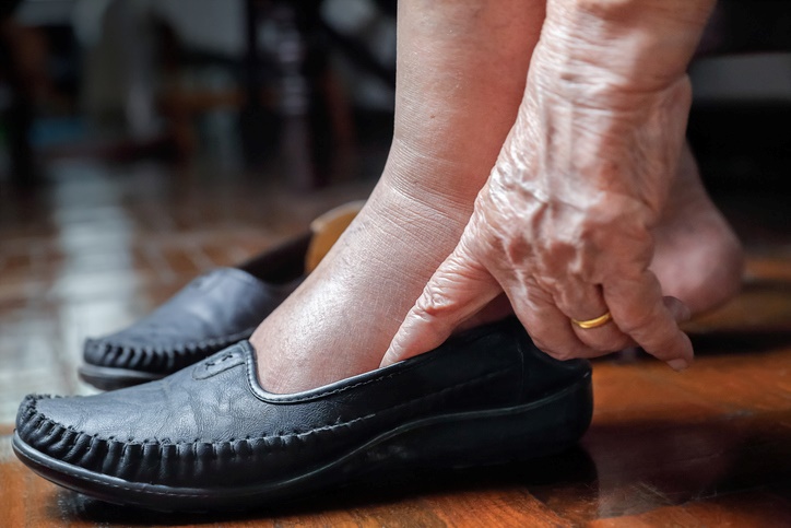 A senior wearing diabetic shoes for comfort and safety in Houston, TX